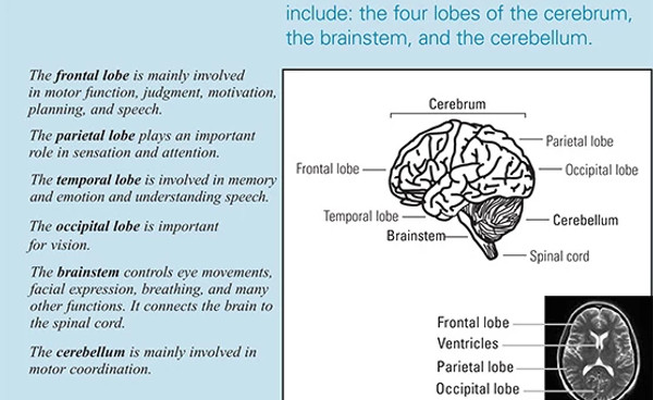 brain-tumors-brochure556x381.jpg