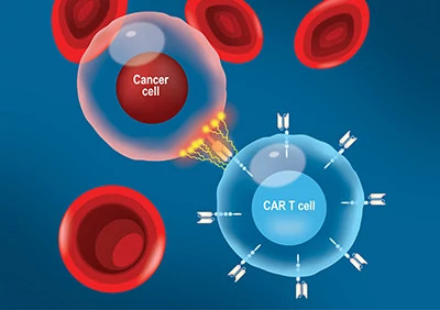 car-t-cell-attacking-cancer-cell-400x282.jpg