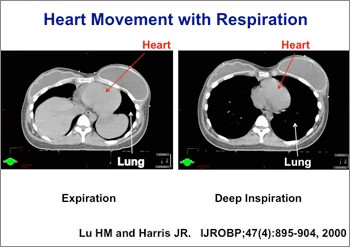 heart-movement-with-respiration-smaller350x247.jpg