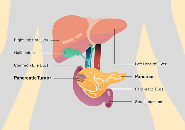 pancreas-illustration720x507.jpg