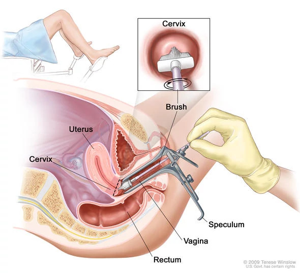 pap-smear590x538.jpg