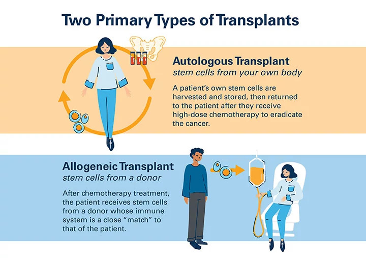 stem-cell-transplant-two-types720x507.jpg